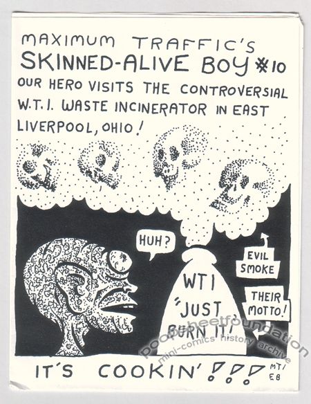 Skinned-Alive Boy #10