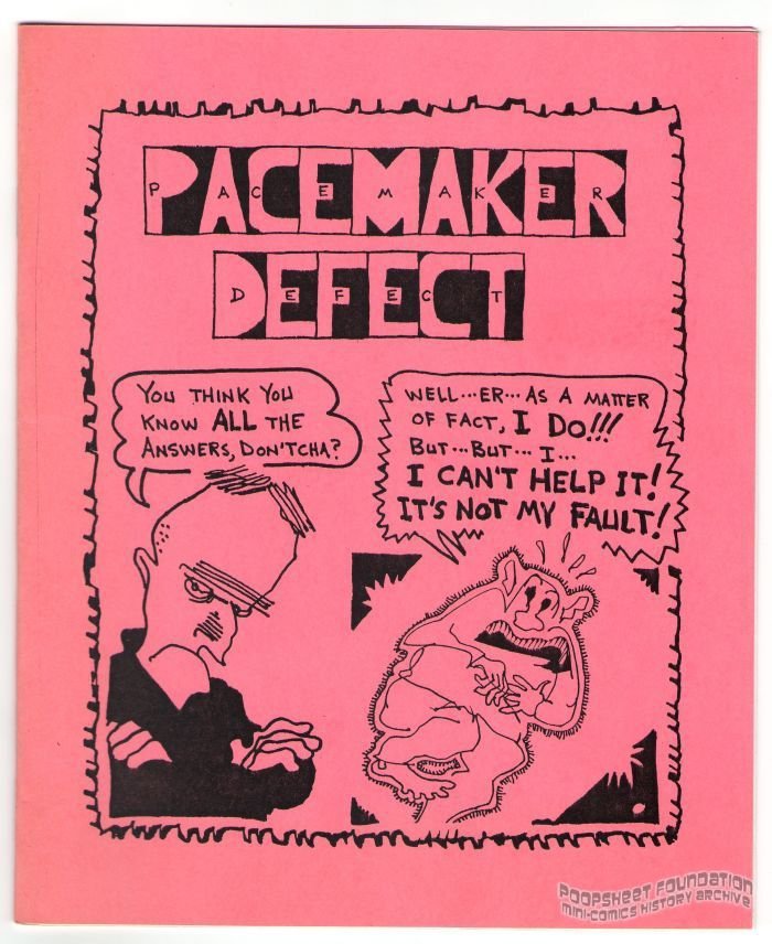 Pacemaker Defect