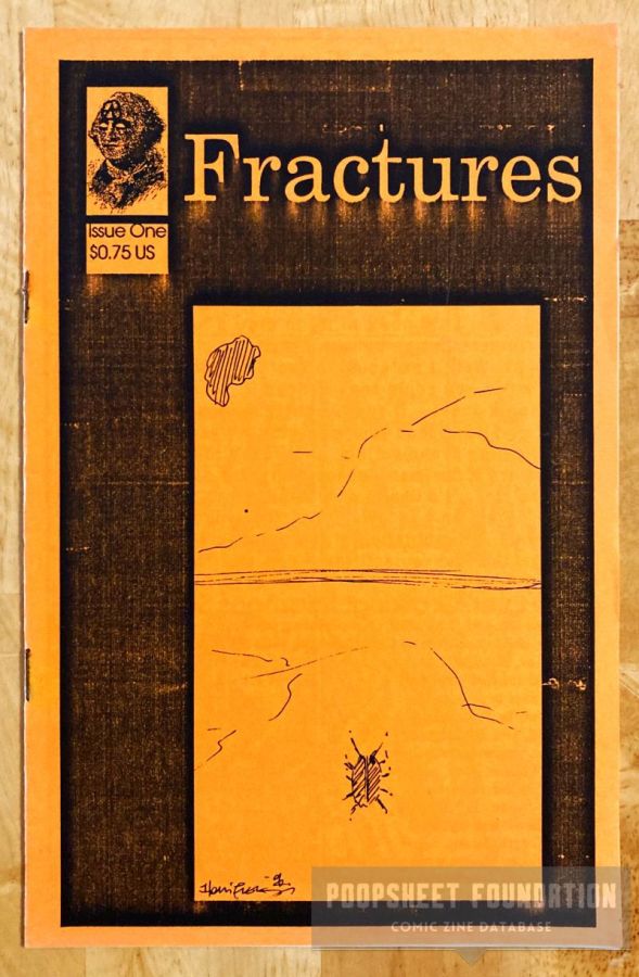 Fractures #1