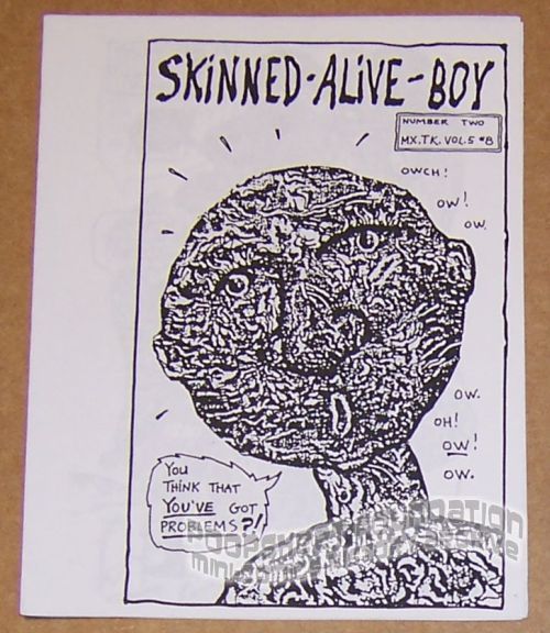 Skinned-Alive Boy #02