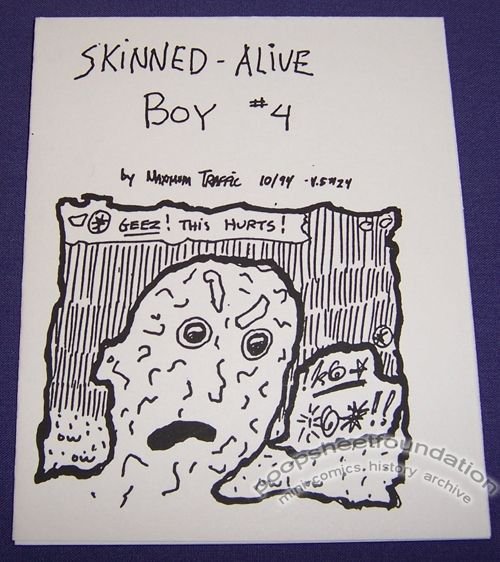 Skinned-Alive Boy #04