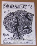 Skinned-Alive Boy #03